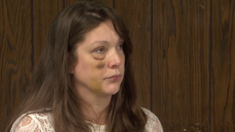 Holly said her attacker, identified as Patrick Rosemond, might have caused damage that she...